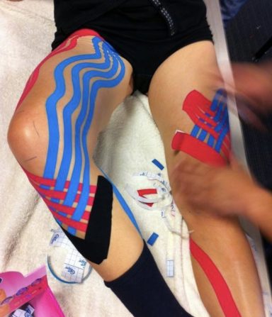 Behandelde benen met kinesiotape in blauw, rood en zwart in diverse patronen.